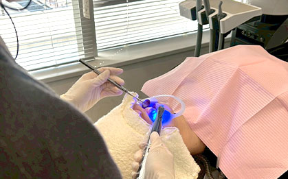 ホワイトニング施術風景